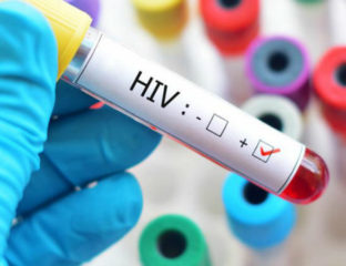 HIV functional cure