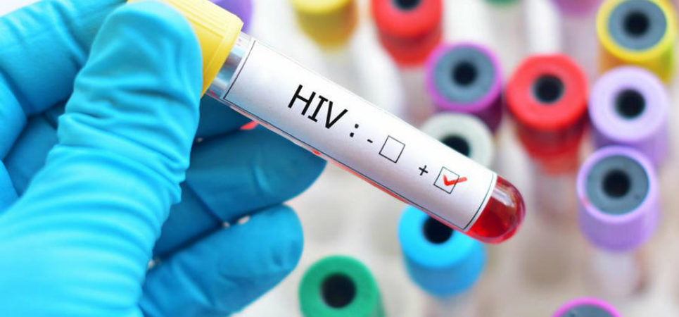 HIV functional cure